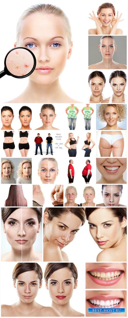 Before and after, beauty and body care - stock photos